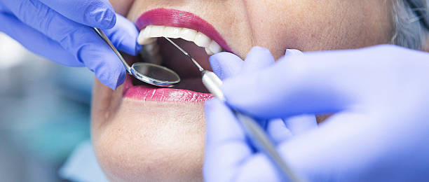 Best Emergency Treatment for Oral Infections in Eunice, LA
